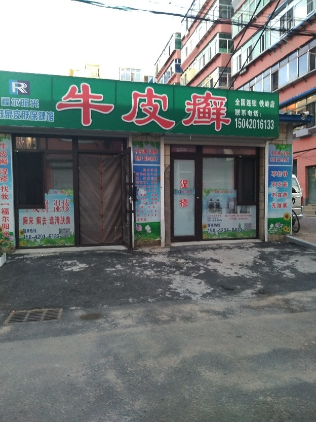牛皮癣