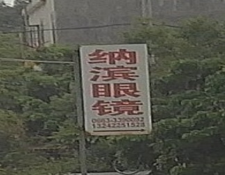 纳滨眼睛